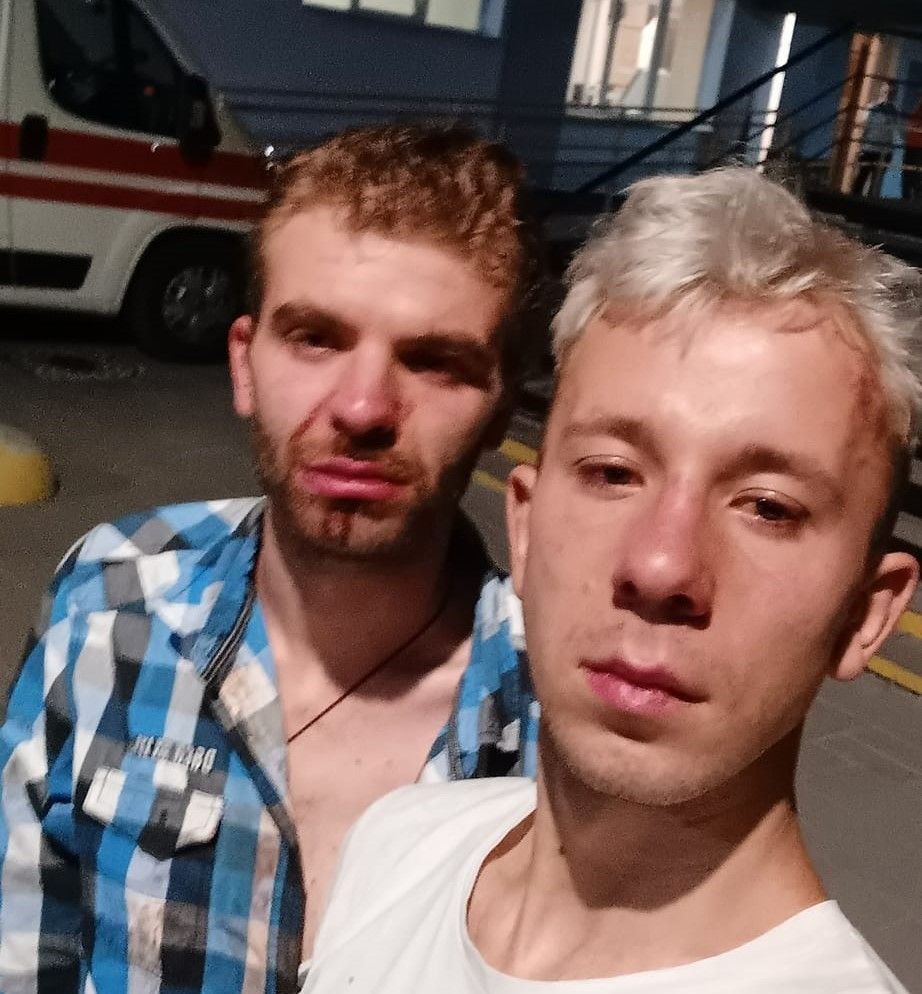 В Україні дали перший реальний тюремний термін за гомофобний злочин