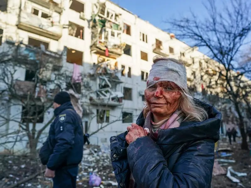 Invaded by Russia: Ukrainian teacher Olena Kurilo was injured after a Russian strike on an apartment building in Chuhuiv, Kharkiv region, Ukraine, on February 25, 2022